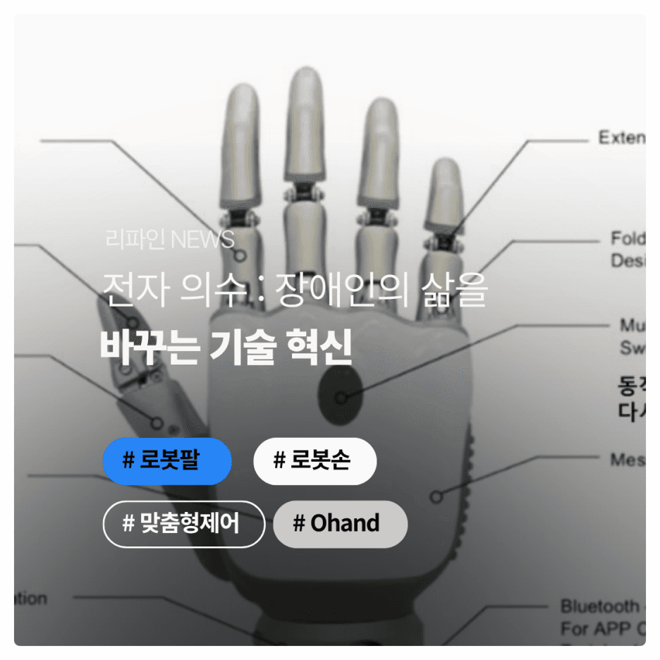 전자의수: 장애인의 삶을 바꾸는 기술 혁신