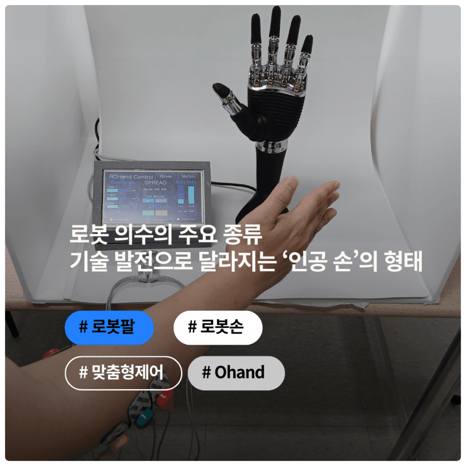 로봇 의수의 주요 종류 : 기술 발전으로 달라지는 ‘인공 손’의 형태